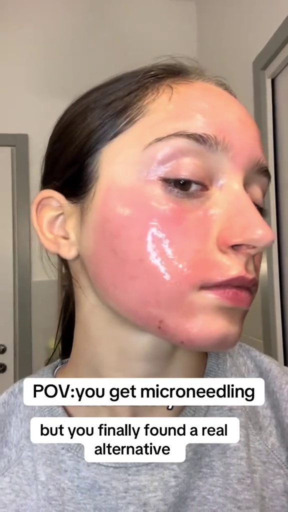 TikTok post by @albesole